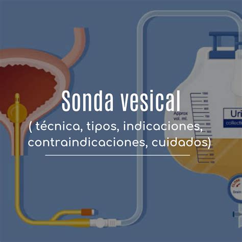 Sondaje vesical en mujeres